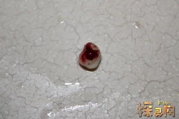 梦见牙掉了一个是什么征兆(孕妇梦见牙掉了一个是什么征兆)