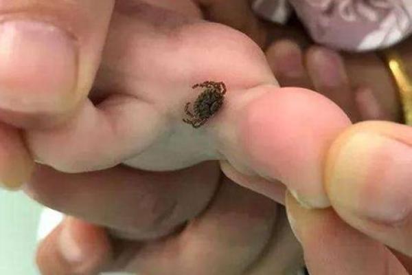 梦见好多虫子(梦见好多虫子是什么预兆 女性)