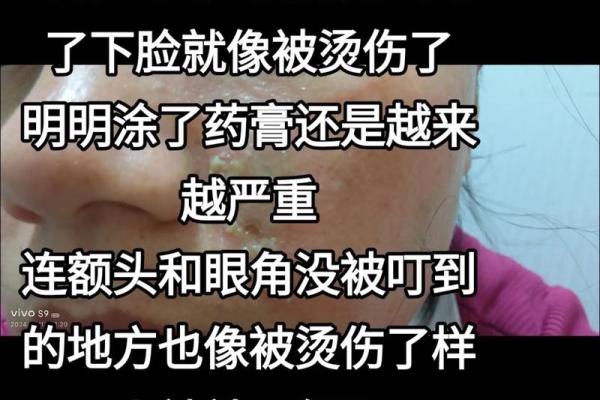 梦见很多虫子(梦见很多虫子钻进皮肤我又拽出来了)