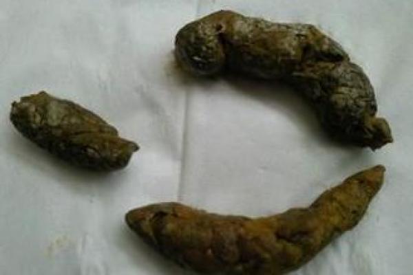 梦见拉屎一大堆是什么意思(梦见拉屎一大堆是什么意思周公解梦女人)